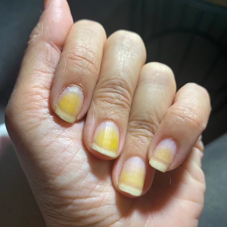 Flormar Oje Kullanımı Sonrası Tırnaklarda Sorun