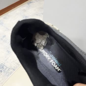 Skechers Ayakkabıda Erken Yıpranma Ve Trendyol'un Çözüm Eksikliği