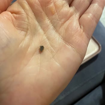 Eti Bisküvinin İçinden Çıkan Yabancı Madde Şoku