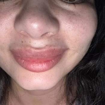 Dr. Hakan Genç Farklı İşlem Uygulandı