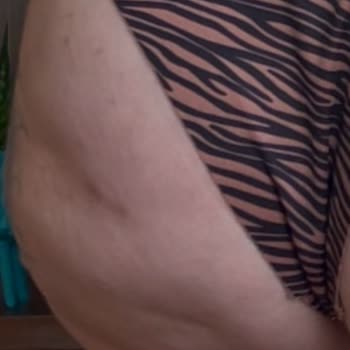 Dolgu Ve Dikiş Kabusu: Sağlık Ve Psikoloji Tehlikede