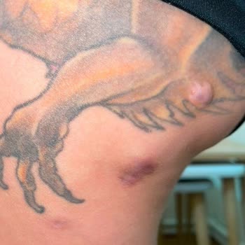 Dolgu Ve Dikiş Kabusu: Sağlık Ve Psikoloji Tehlikede