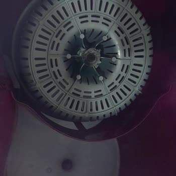 Parex Temizlik Kovası Sıkma Aparatı Sorunu