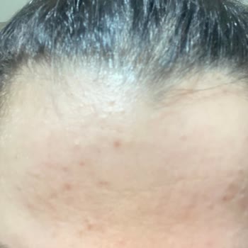 Wiwify Ürünleri Cildimi Mahvetti