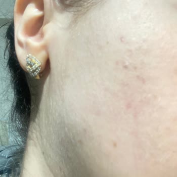 Wiwify Ürünleri Cildimi Mahvetti