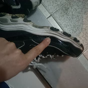 Skechers Ayakkabıda Beklenmedik Yırtılmalar Ve Mağaza İlgisizliği