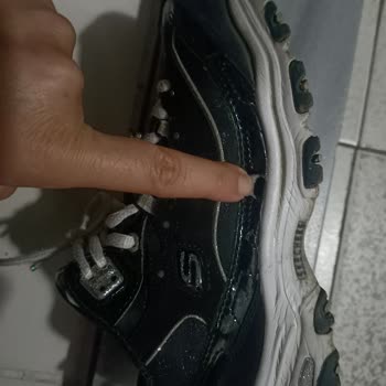 Skechers Ayakkabıda Beklenmedik Yırtılmalar Ve Mağaza İlgisizliği