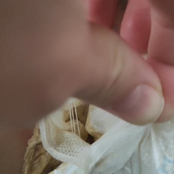 Molfix Bebek Bezi Kalite Sorunu Ve İletişim Eksikliği