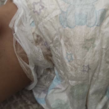 Molfix Bebek Bezi Kalite Sorunu Ve İletişim Eksikliği