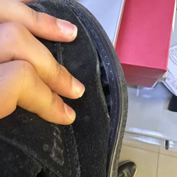 Hotiç Ayakkabılarında Yaşanan Sorun Ve Müşteri Hizmetleri Deneyimi