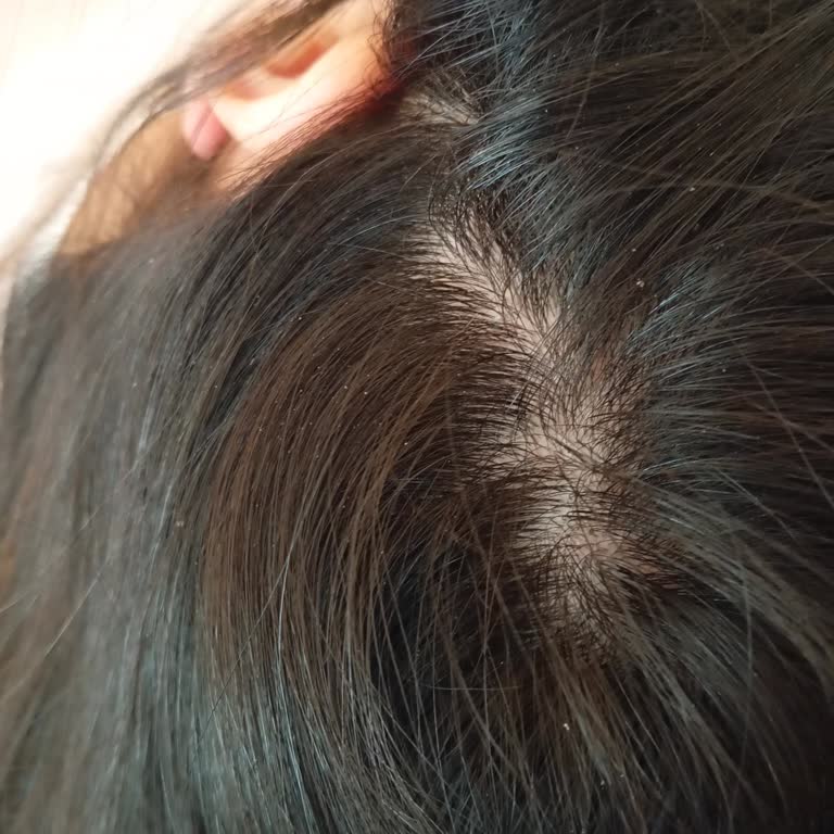 Saç Kesimi Ve Hizmet Kalitesinden Memnuniyetsizlik