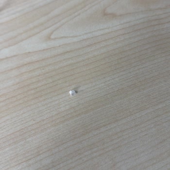 Beyaz Dent Ağız ve Diş Sağlığı Merkezi Arnavutköy Dolgu Sorunu