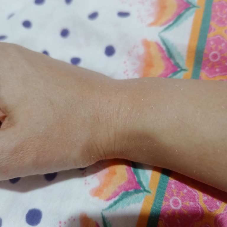 Bioderma Spot Sunscreen Too Thick & Leaves White Residue