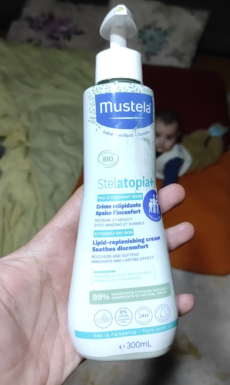 Mustela Stelatopia+ Caused Severe Skin Redness on My Baby video cover