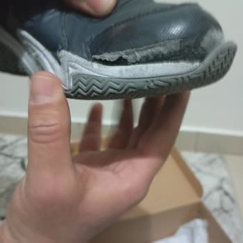 Skechers Çocuk Ayakkabısı 2 Ayda Açıldı, Çocuğumun Ayağında Yaralar Oluştu