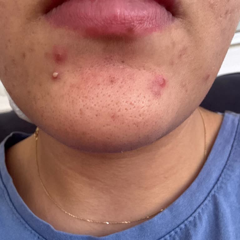 Caudalie Vinopure Serisi Hayal Kırıklığı