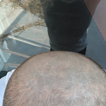 Bitkisel Boya Kabusu: Yedi Yıllık Yeşil Saç Sorunu