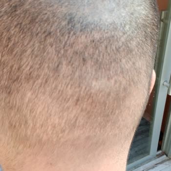 Bitkisel Boya Kabusu: Yedi Yıllık Yeşil Saç Sorunu