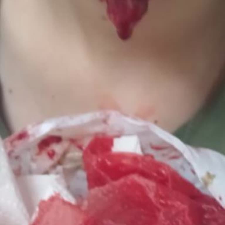 Ağız Ve Diş Sağlığı Hastanesinde Korkunç Deneyim