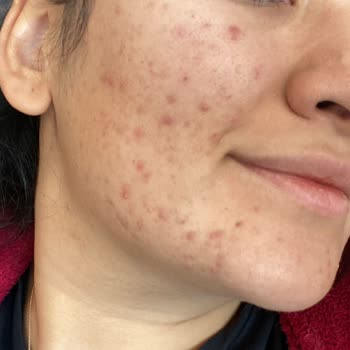 Ceres Kozmetik Cilt Bakım Ürünleri Hayal Kırıklığı Yarattı