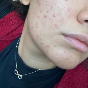 Ceres Kozmetik Cilt Bakım Ürünleri Hayal Kırıklığı Yarattı