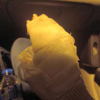 AVM'de Kahve Kazası Ve Yetersiz Yardım