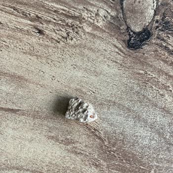 Hasata İçinden Çıkan Yabancı Maddeyi Kabul Etmedi!