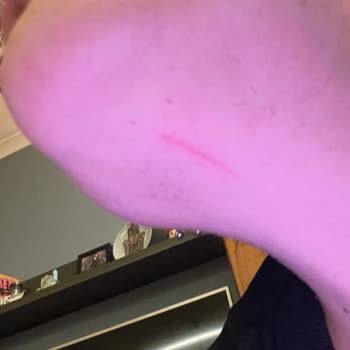 Philips Epilatör Kullanımında Güvenlik Sorunu