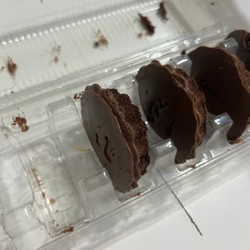 Ülker Üründen Çıkan Tırnak Şoku