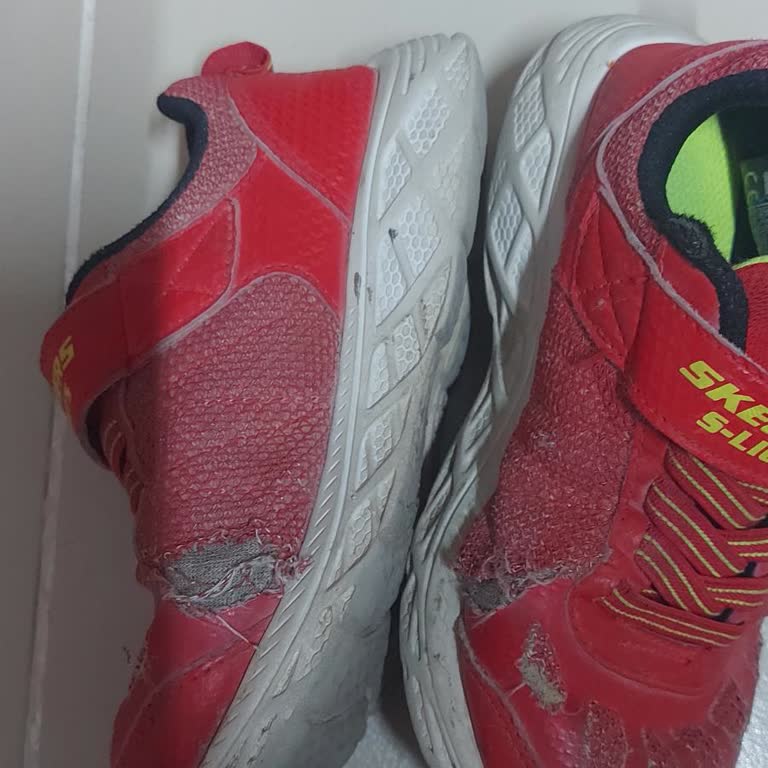 Skechers Ayakkabının Kalitesizliği Ve Müşteri Hizmetleri Sorunu