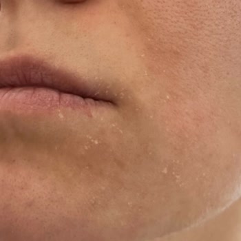 Bioderma Atoderm Yüz Kremi Cildimi Kuruttu Ve Leke Yaptı!