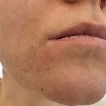 Bioderma Atoderm Yüz Kremi Cildimi Kuruttu Ve Leke Yaptı!