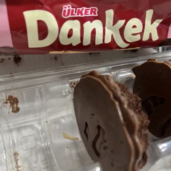 Ülker Dankek'te Şok Edici Tırnak Sürprizi!