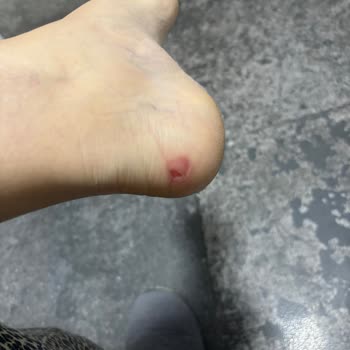 Boyner'den Aldığım Clarks Bot Ayağımı Parçaladı