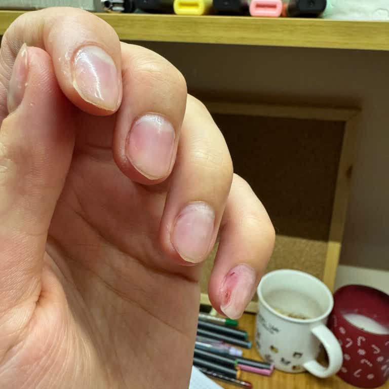 Tırnak Zararı Ve Kalite Düşüşü: Hayal Kırıklığı