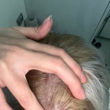 Saç Boyası Alerjisi Ve Beklenmedik Reaksiyon