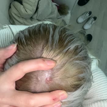 Saç Boyası Alerjisi Ve Beklenmedik Reaksiyon