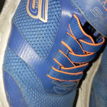 Skechers Ayakkabıda Üç Ayda Çatlak Sorunu