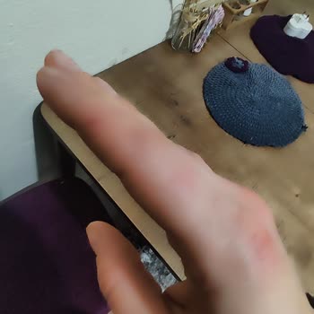 Neutrogena Krem Sonrası El Yanması Ve Döküntü