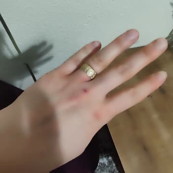 Neutrogena Krem Sonrası El Yanması Ve Döküntü