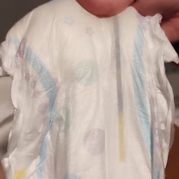 Molfix Bezi Sızdırma Sorunu Ve Müşteri Hizmetleri Hayal Kırıklığı