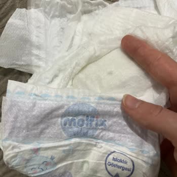 Molfix Bezlerinde Kalite Düşüşü Ve Pişik Sorunu