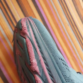 Skechers Ayakkabıda Beklenmedik Kalite Sorunları