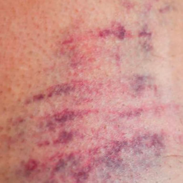 Bend Koltuk Tasarım Hatası: Çocuk Güvenliği Tehlikede