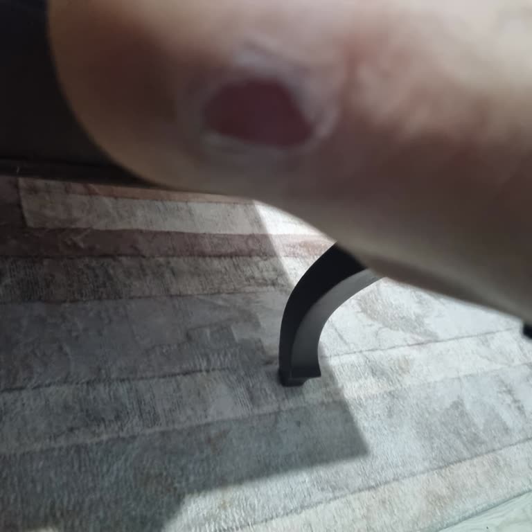 Lumberjack Ayakkabı Yara Etti Ve Tehdit Edildim!