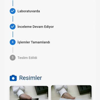 Yanıltıcı Servis Süreci Ve Çözülmeyen Teknik Sorunlar