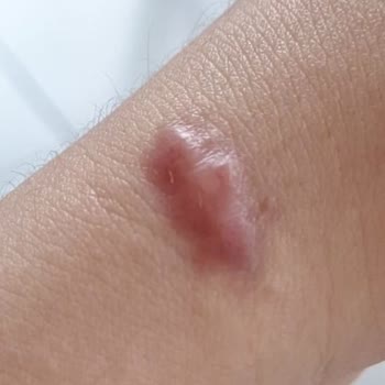 Ameliyat Sonrası Kötüleşen Durum Ve İlgisiz Tavır
