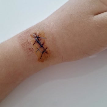 Ameliyat Sonrası Kötüleşen Durum Ve İlgisiz Tavır