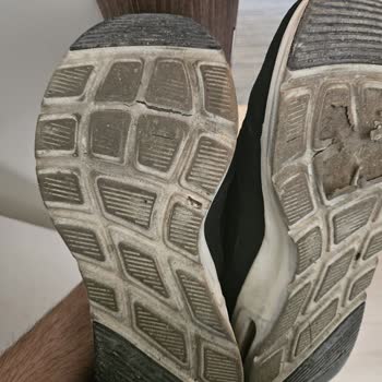 Skechers Ayakkabıda Beklenmedik Deformasyon