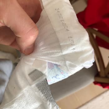 Bebek Bezinde Çift Taraflı Bant Tehlikesi